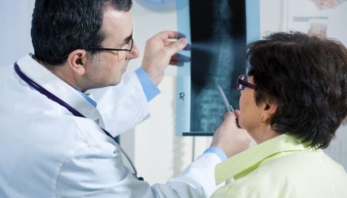 рентгенова снимка на гръбначния стълб с остеохондроза