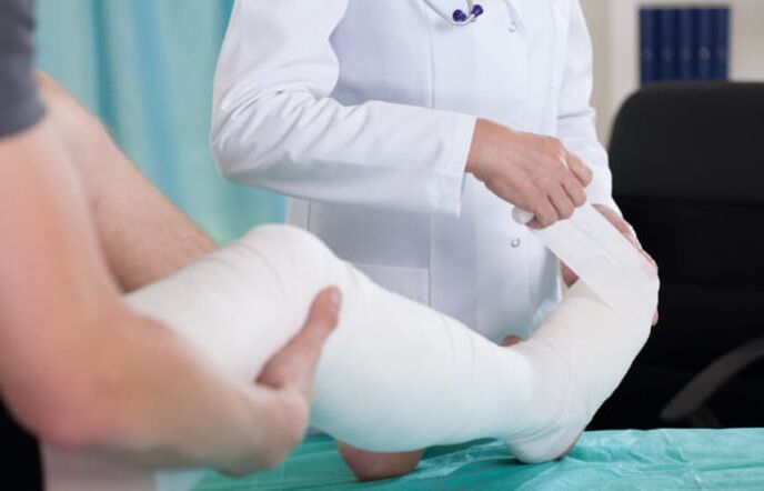 гипсова превръзка за болки в коляното